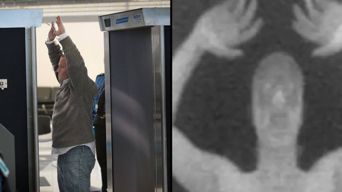 Les aéroports ont été contraints d'apporter des modifications majeures aux appareils à rayons X en raison du choc suscité par ce qu'ils pouvaient voir